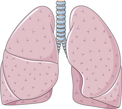 Anterior illustration of both lungs and trachea: three lobes on the patient's right and two on the left.
